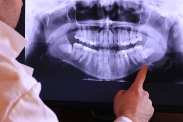 Best Broken Tooth Emergency  in Campti, LA