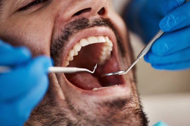 Best Affordable Emergency Dental Care  in Campti, LA