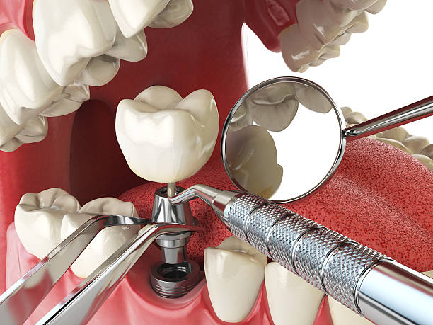 Best Tooth Infection Emergency Dentist  in Campti, LA